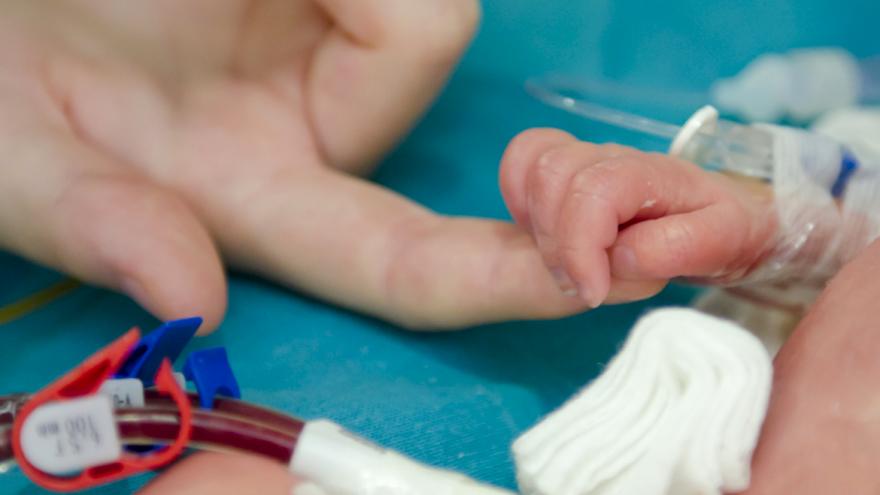 Texto Alternativo: Un estudio revela la influencia del tiempo de gestación en el riesgo de displasia broncopulmonar