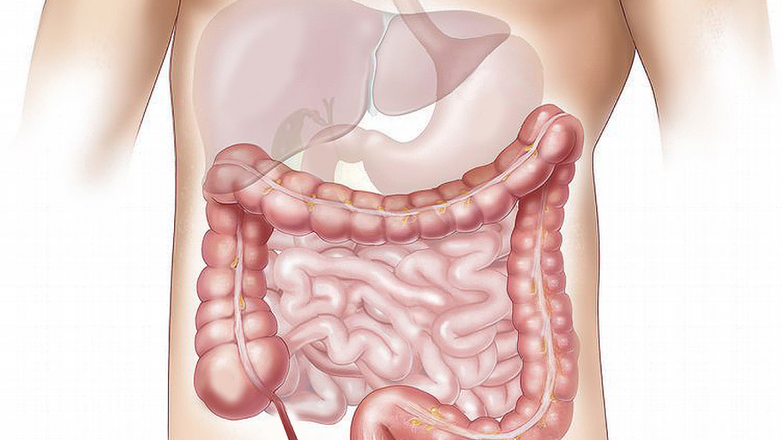 Texto Alternativo: La Unidad de Coloproctología de La Princesa lidera una jornada sobre incontinencia anal