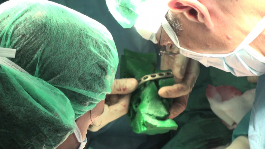 Texto Alternativo: El Hospital Gregorio Marañón implementa la impresión 3D en cirugía maxilofacial