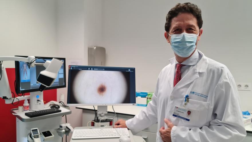 Texto Alternativo: Una investigación del Hospital 12 de Octubre demuestra que una crema para tratar dermatitis atópica es capaz de reducir las lesiones cutáneas de un tipo de cáncer de piel