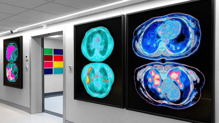 Texto Alternativo: El Servicio de Medicina Nuclear del Hospital Gregorio Marañón pone en marcha un proyecto de humanización a través del arte
