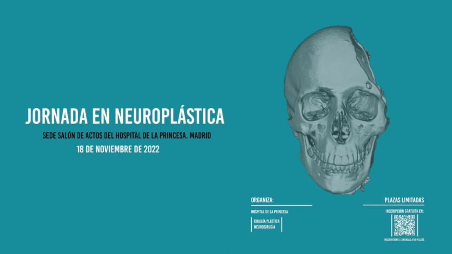 Texto Alternativo: El Hospital de La Princesa organiza una jornada dedicada a la Neuroplástica