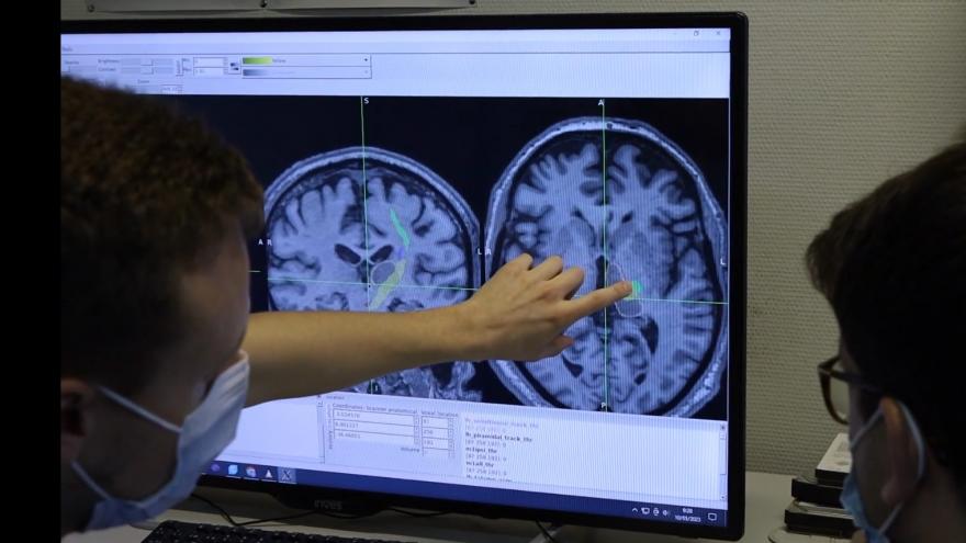Texto Alternativo: El Hospital público Clínico San Carlos de la Comunidad de Madrid reduce un 80% el temblor esencial y asociado a la enfermedad de Parkinson