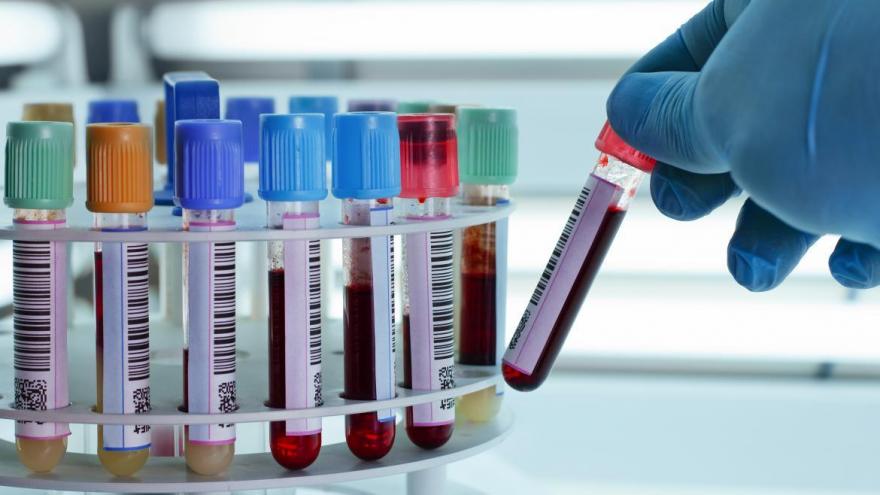 Texto Alternativo: El Hospital Universitario de Fuenlabrada celebra un nuevo 'maratón' de donación de sangre