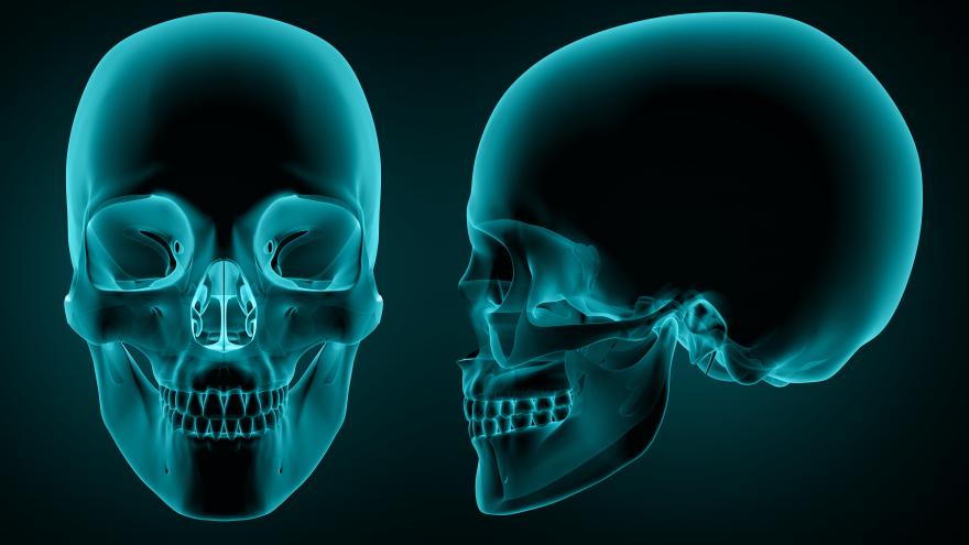 Texto Alternativo: El Hospital de La Princesa impulsa los avances científicos en Cirugía Oral y Maxilofacial a través del sexto Congreso Madrileño de la especialidad