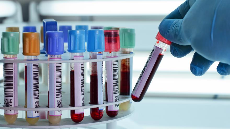 Texto Alternativo: El Laboratorio Clínico Central, que da servicio a seis hospitales públicos de la región, renueva y amplía la acreditación de su actividad