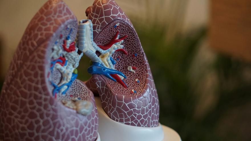 Texto Alternativo: El jefe del Servicio de Oncología Médica del Hospital Puerta de Hierro, coautor principal de un estudio que consolida un cambio de paradigma en el tratamiento del cáncer de pulmón