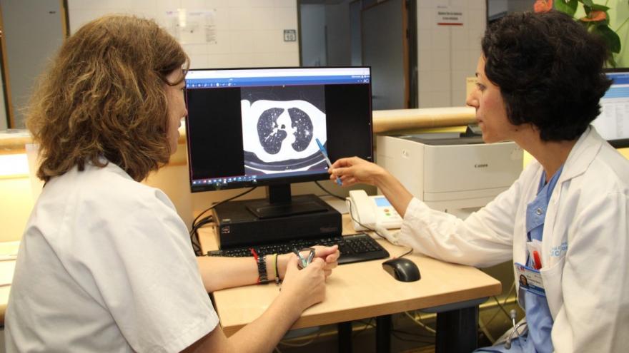 Texto Alternativo: El Hospital público Clínico San Carlos de la Comunidad de Madrid inicia el reclutamiento de pacientes para el proyecto Cassandra de cribado de cáncer de pulmón