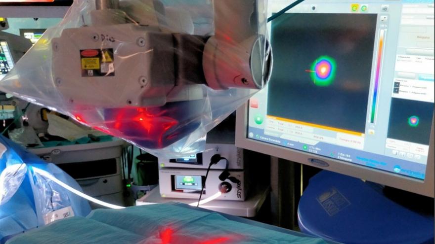 Texto Alternativo: El Hospital público Clínico San Carlos utiliza una técnica novedosa en radiolocalización de lesiones pulmonares con navegador electromagnético