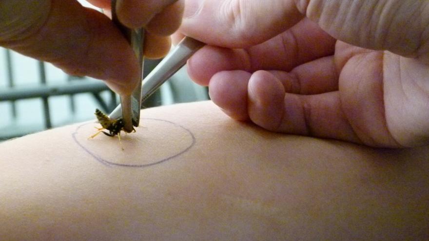 Texto Alternativo: El Hospital público Fundación Alcorcón refuerza la seguridad de los pacientes alérgicos al veneno de abejas y avispas