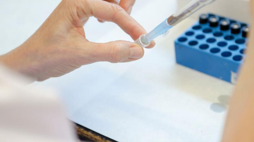 Texto Alternativo: Investigadores del Hospital público Gregorio Marañón y el CIBER publican avances en el diagnóstico de la tuberculosis pediátrica mediante biomarcadores plasmáticos