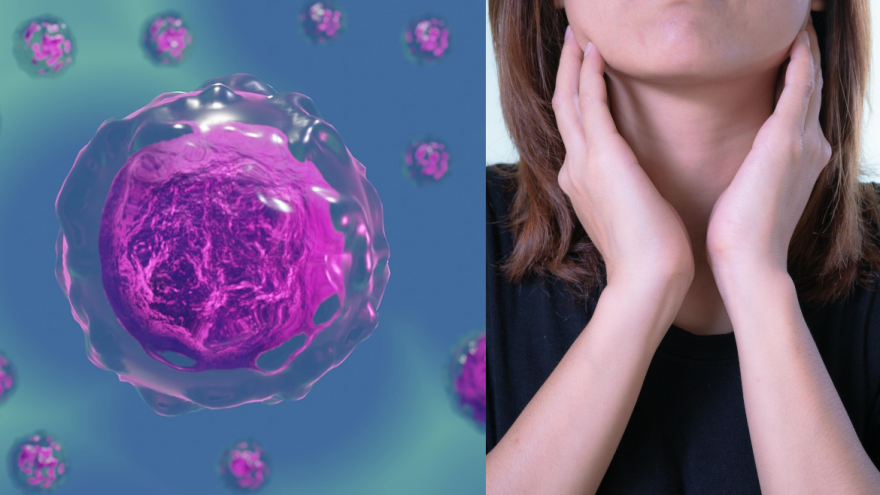 Texto Alternativo: El Hospital público Ramón y Cajal acoge un encuentro bilateral España-Polonia sobre cáncer de laringe