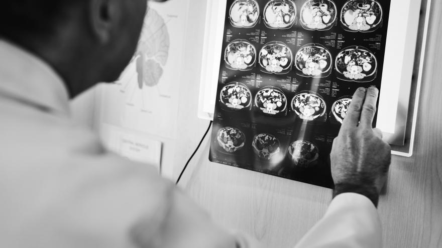 Texto Alternativo: El Hospital público de La Princesa trata al año a más de 500 pacientes con epilepsia