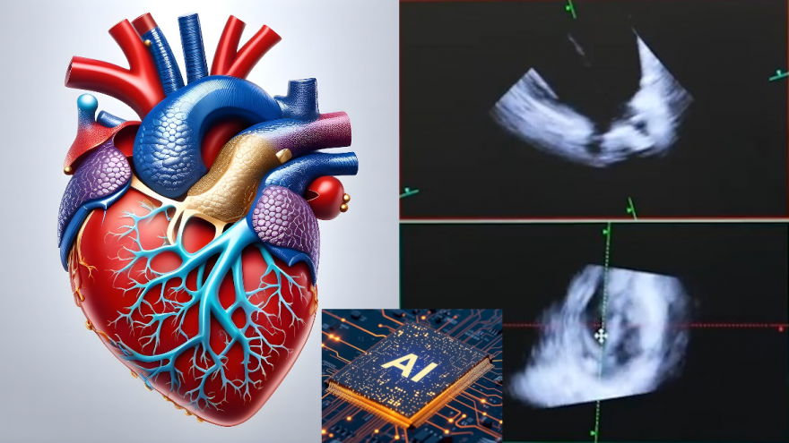Texto Alternativo: El Hospital público Ramón y Cajal usa la ecografía en 4D de forma pionera para hacer cirugías sin corazón abierto