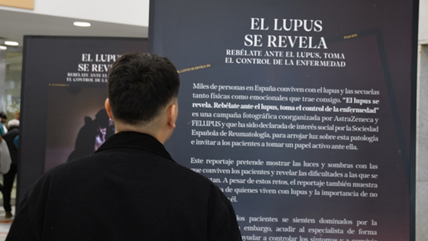 Texto Alternativo: El Hospital público Ramón y Cajal acoge la exposición fotográfica itinerante 'El lupus se revela'